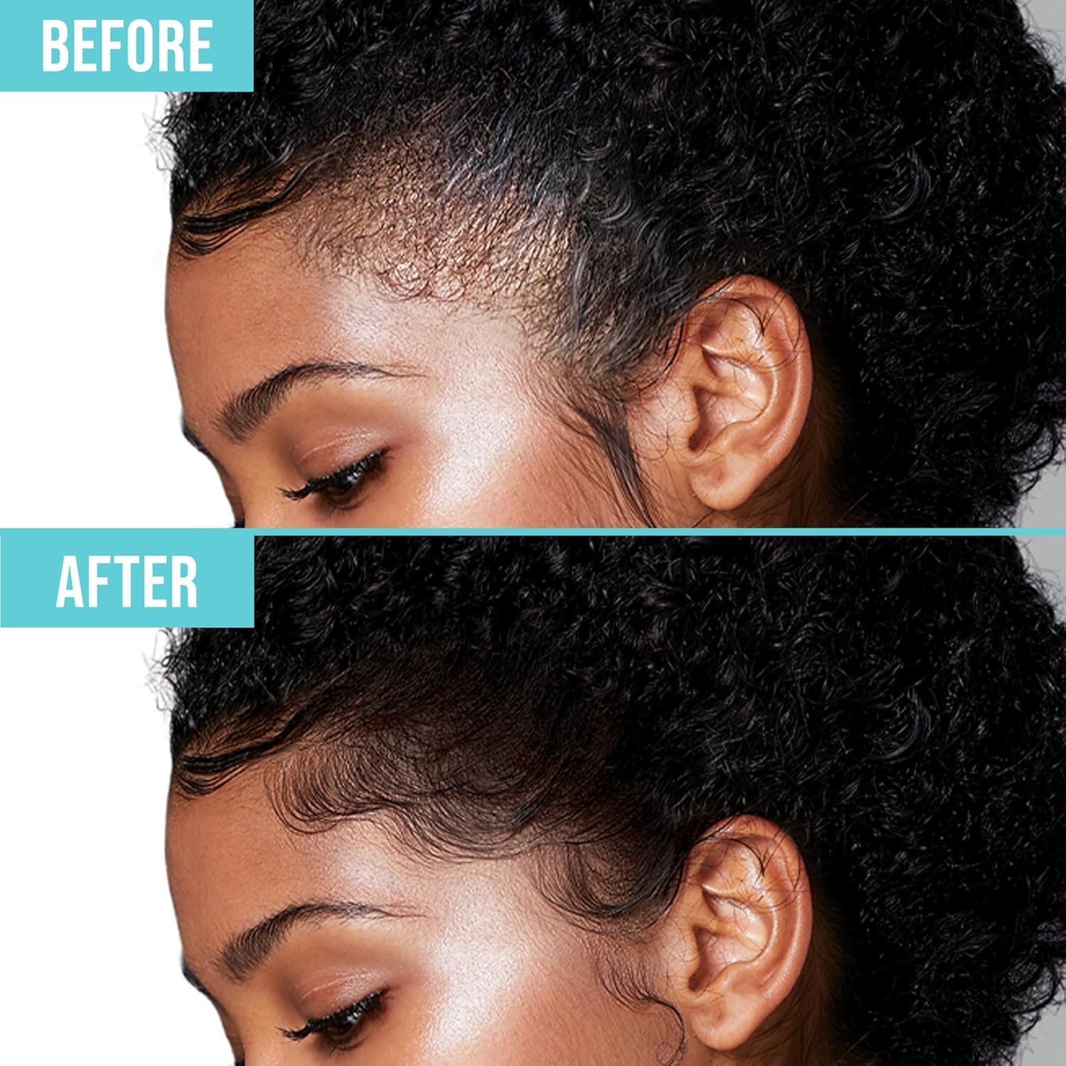 image:imageKISS COLORS amp CARE Maximum Hold Edge Fixer NonGreasy Gel Formula Infused With Biotin B7 24 Hour Hold Sweet Peach Scented 338 Fl Oz 100 mlPineapple